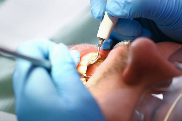 Best Emergency Treatment for Oral Infections in Williamsburg, FL